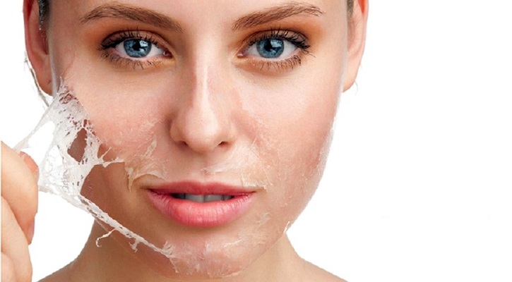 پاکسازی پوست با لیزر بهتر است و یا لایه برداری